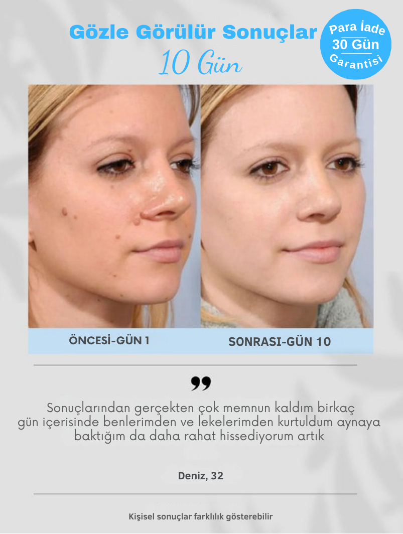 Plazma Pen™ Cilt Bakım Kalemi